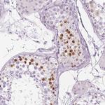 BEND2 Polyclonal Antibody