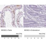 BEND2 Antibody in Immunohistochemistry (IHC)
