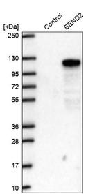 BEND2 Antibody in Western Blot (WB)