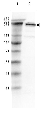 SPTBN1 Antibody in Western Blot (WB)