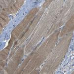 NETO2 Antibody in Immunohistochemistry (Paraffin) (IHC (P))