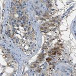 NETO2 Antibody in Immunohistochemistry (Paraffin) (IHC (P))