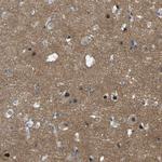 GPR158 Antibody in Immunohistochemistry (Paraffin) (IHC (P))