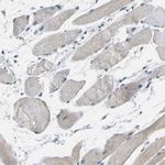 GPR158 Polyclonal Antibody