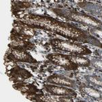 PCDHB5 Polyclonal Antibody