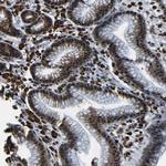 C17orf85 Polyclonal Antibody