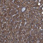 GGT7 Polyclonal Antibody