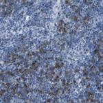 FCRL1 Antibody in Immunohistochemistry (IHC)