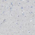 FCRL1 Antibody in Immunohistochemistry (IHC)