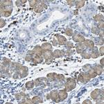 FCRL1 Polyclonal Antibody