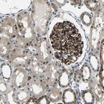 SYDE1 Antibody in Immunohistochemistry (Paraffin) (IHC (P))