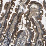 SYDE1 Antibody in Immunohistochemistry (Paraffin) (IHC (P))