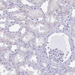 MYL7 Antibody in Immunohistochemistry (Paraffin) (IHC (P))