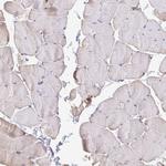 MYL7 Polyclonal Antibody