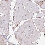 MYL7 Antibody in Immunohistochemistry (IHC)