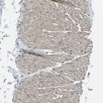 TNFAIP1 Antibody in Immunohistochemistry (IHC)