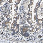 DDX26B Polyclonal Antibody