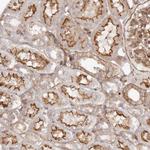 PTPN22 Antibody in Immunohistochemistry (Paraffin) (IHC (P))