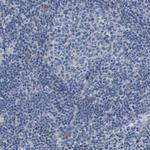 DDRGK1 Polyclonal Antibody
