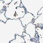 PARD6B Antibody in Immunohistochemistry (IHC)