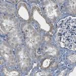 PARD6B Antibody in Immunohistochemistry (IHC)