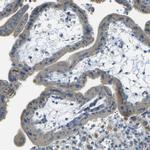 PARD6B Antibody in Immunohistochemistry (IHC)