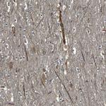 RELL1 Antibody in Immunohistochemistry (Paraffin) (IHC (P))