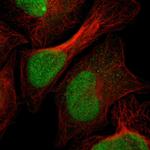 SPCS2 Polyclonal Antibody