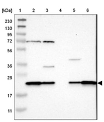 SPCS2 Antibody in Western Blot (WB)