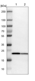 SPCS2 Antibody in Western Blot (WB)
