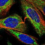 TBC1D15 Polyclonal Antibody