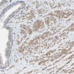 TOR1B Polyclonal Antibody