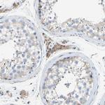 TOR1B Antibody in Immunohistochemistry (Paraffin) (IHC (P))