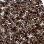 LRRC70 Polyclonal Antibody