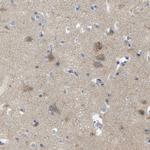 C6orf170 Antibody in Immunohistochemistry (Paraffin) (IHC (P))