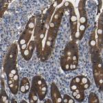 C6orf170 Antibody in Immunohistochemistry (Paraffin) (IHC (P))