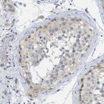 C6orf170 Antibody in Immunohistochemistry (Paraffin) (IHC (P))