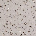 DNAJC1 Polyclonal Antibody