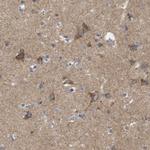 FAM171B Antibody in Immunohistochemistry (IHC)