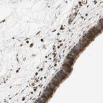 PCDHB10 Polyclonal Antibody