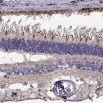 LRIT3 Antibody in Immunohistochemistry (IHC)