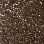 PREB Polyclonal Antibody