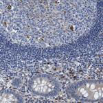 GIMAP2 Polyclonal Antibody