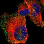 HIP1 Polyclonal Antibody