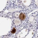 C16orf89 Antibody in Immunohistochemistry (IHC)