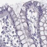 C16orf89 Antibody in Immunohistochemistry (IHC)