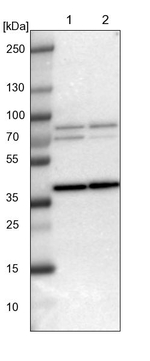 WBSCR17 Antibody in Western Blot (WB)