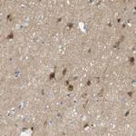 MAGI2 Antibody in Immunohistochemistry (IHC)
