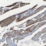 NCMAP Polyclonal Antibody