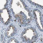 HSPA12B Polyclonal Antibody